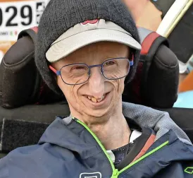 Sammy Basso, the World's Oldest Progeria Patient, Passes Away at 28