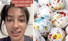 Canadian Student Breaks Jaw Trying to Bite a Jawbreaker Candy