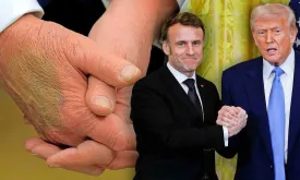 Trump's Hand Bruises from Firm Handshakes