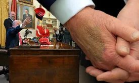 White House Reveals the Mystery Behind the Bruise on President Trump's Hand