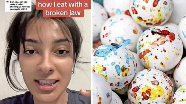 Canadian Student Breaks Jaw Trying to Bite a Jawbreaker Candy