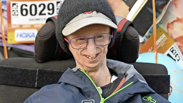 Sammy Basso, the World's Oldest Progeria Patient, Passes Away at 28